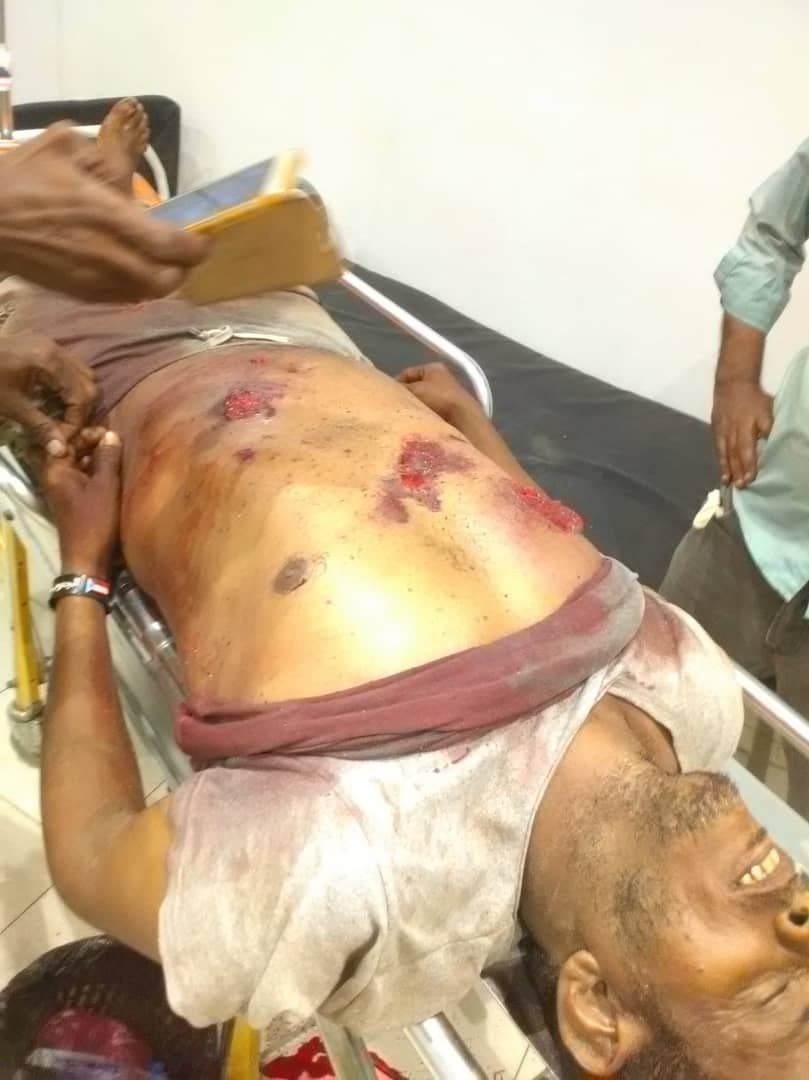 مقتل أحد حراسة ديوان محافظة لحج 