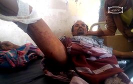قناصة المليشيات الحوثية تستهدف مواطناً شمال الضالع وتصيبه بجروح