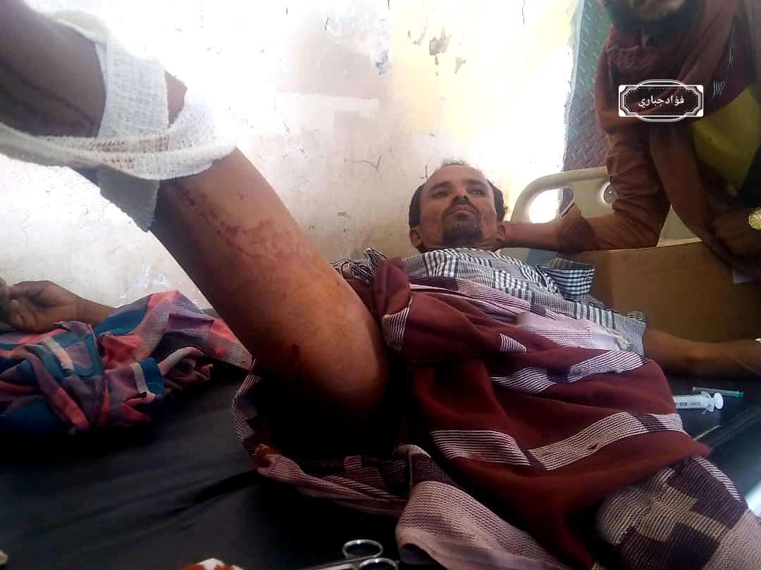 قناصة المليشيات الحوثية تستهدف مواطناً شمال الضالع وتصيبه بجروح