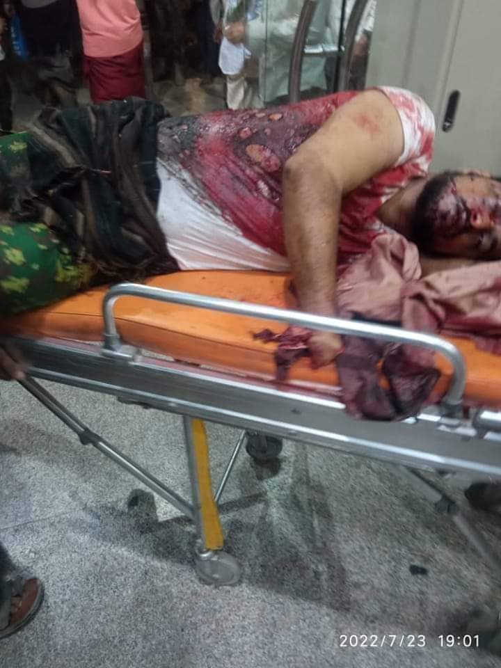 مقتل شخص في انفجار قنبلة بمسجد بمحافظة لحج