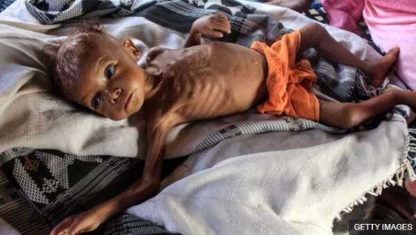 تحذيرات دولية متواصلة من تفاقم المعاناة الإنسانية في اليمن