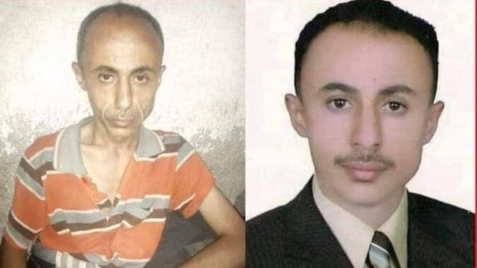 صورتان تلخصان المأساة.. هكذا يعذب الحوثيون الصحافيين المختطفين!  