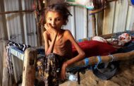 بينها اليمن .. الأمم المتحدة: معدلات الجوع ارتفعت 10 أضعاف في عدة دول