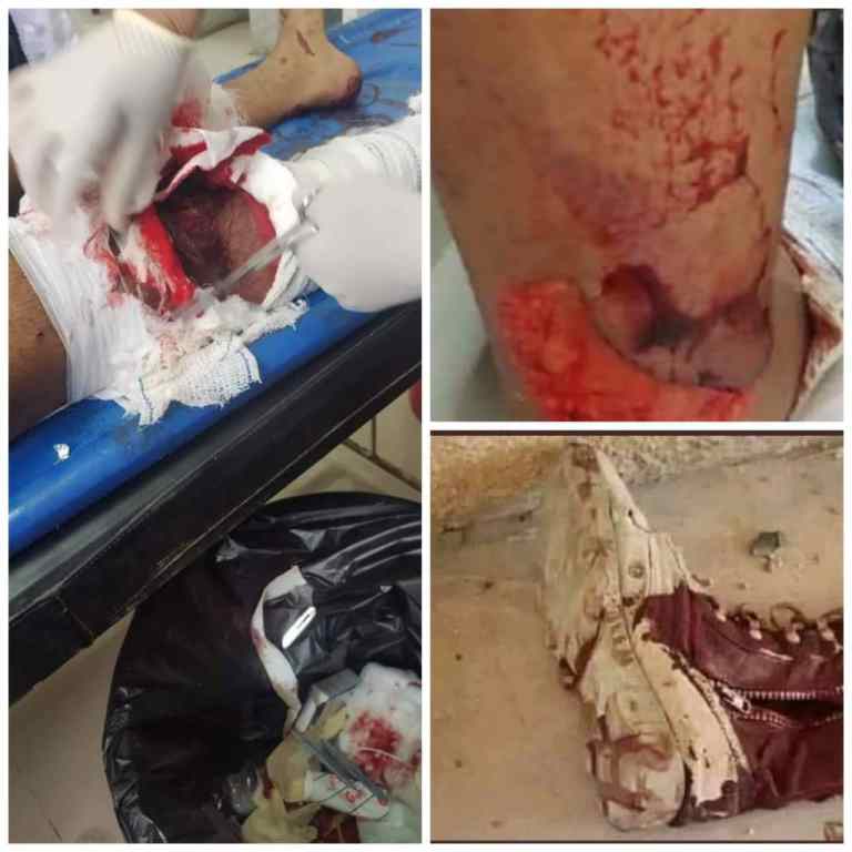 اصابة جنود بهجوم طائرة مسيرة وقنص حوثي في الضالع