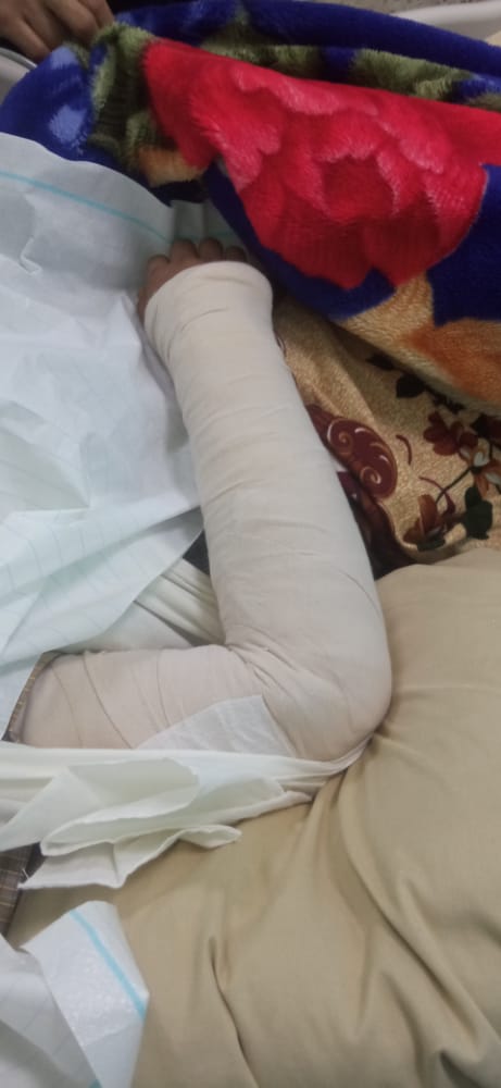 قناصة الحوثي تستهدف النساء بمنطقة شمال الضالع