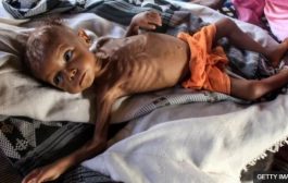 الصليب الأحمر : اثنان من كل ثلاثة يمنيين، يعانون من فقدان الأمن الغذائي