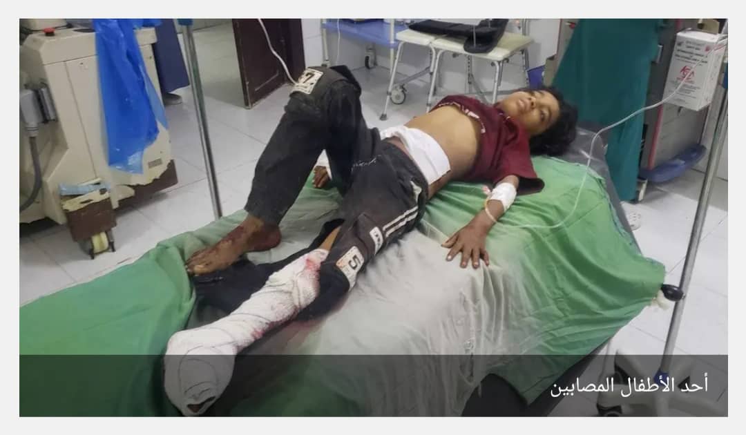 جريمة حوثية في تعز.. إصابة 3 أطفال من أسرة واحدة