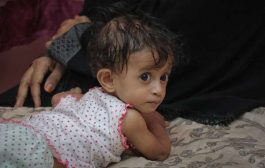 الصحة العالمية تعلن علاج 2255 طفلا مصابا بسوء التغذية في اليمن