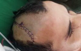 كفيف يتعرض للضرب بالفأس على رأسه شمال اليمن 