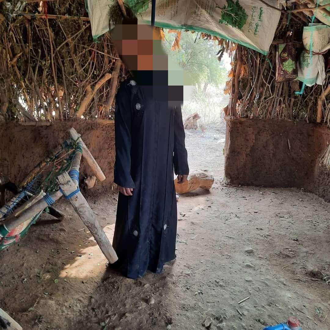 العثور على طفلة مشنوقة داخل عشة في منطقة كعيدنة اليمنية