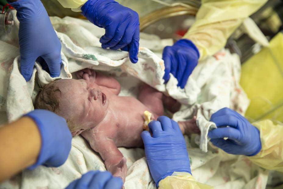العالم يشهد ولادة أول طفل بعد زراعة رحم بواسطة روبوت