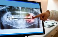 العلماء الأمريكيون يطورون شبكة عصبية قادرة على اكتشاف تسوس الأسنان  
