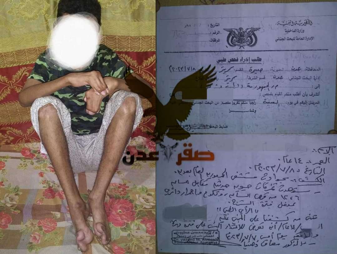 معاق يتعرض للاغتصاب بمنطقة في عدن