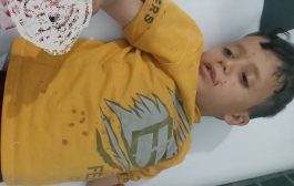 إصابة طفل بانفجار في تعز
