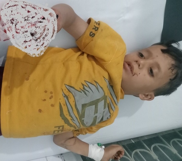 إصابة طفل بانفجار في تعز