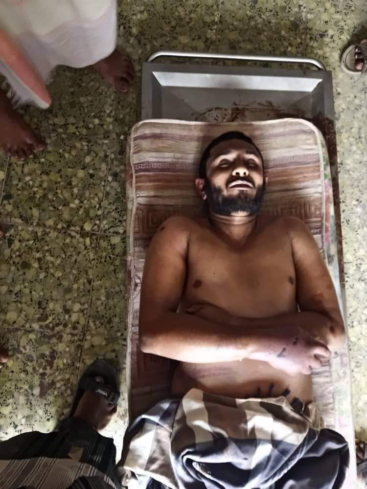 جريمة تعذيب ومقتل محمد شهاب في لحج وغيره ،الأسباب والأبعاد ! ونظرة واقعية لتوصيف إشكالية حقيقية