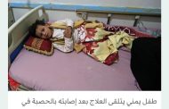 ارتفاع الإصابات بالحصبة في اليمن 3 أضعاف خلال 6 أشهر
