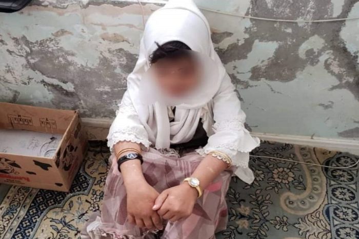 فقدت جزء من نظرها وبيعت كجارية .. طفلة يمنية تتعرض لتعذيب وحشي
