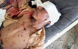 إصابة طفل بجروح بالغة في حيس إثر انفجار مقذوف من مخلفات مليشيات الحوثي