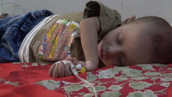 منظمة الصحة الدولية تعبر عن قلقها على أطفال اليمن وخطر مرض الحصبة