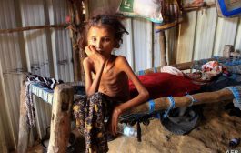 لمكافحة سوء التغذية في اليمن .. اليونسيف تتلقى 3 مليون دولار