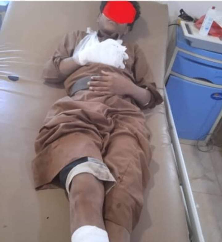 إصابة طفل بانفجار مقذوف في مخيم للنازحين بمحافظة مأرب