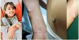 ضحايا الكرة في اليمن ..