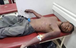 جماعة الحوثي تعذب وترمي مواطنا مهمشا في مناطق التماس غرب تعز