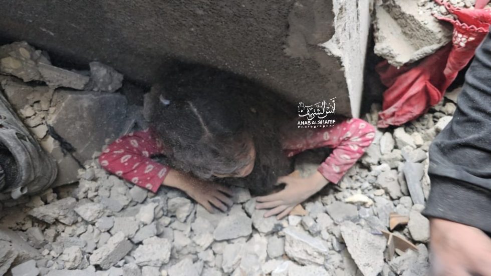 مأساة إنسانية في غزة .. 10 أطفال يفقدون سيقانهم يوميا بسبب العدوان الإسرائيلي