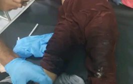 إصابة ثلاثة أطفال بانفجار مقذوف حوثي غرب مديرية قعطبة