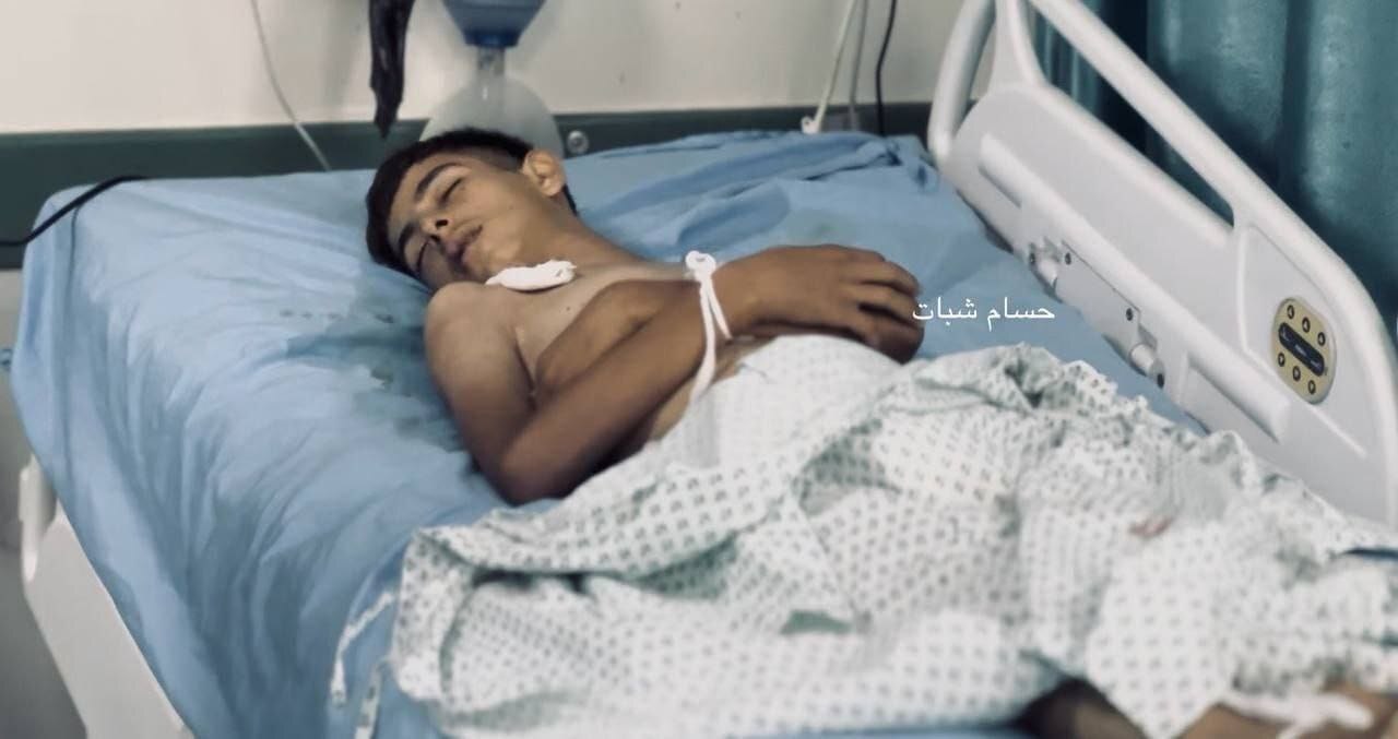 وفاة شاب فلسطيني في غزة جراء سوء التغذية