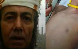 وفاة شاب خنقاً على يد قارئ رقية شرعية للعلاج من السحر في محافظة إب