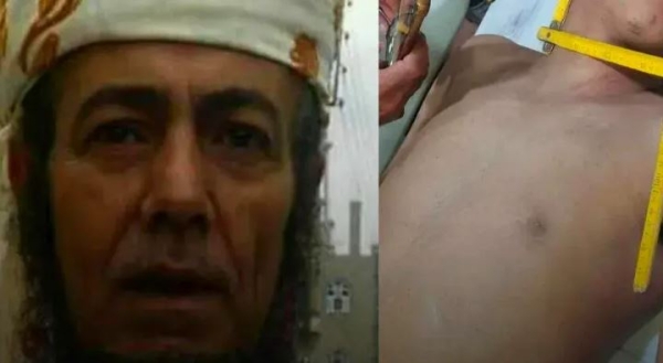 وفاة شاب خنقاً على يد قارئ رقية شرعية للعلاج من السحر في محافظة إب