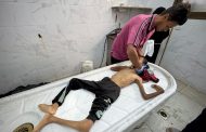 غزة: وفاة أطفال وطاقم طبي ينهار في مجمع الشفاء ضمن ضحايا الجوع