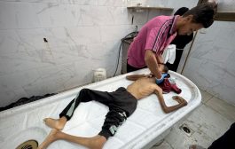 غزة: وفاة أطفال وطاقم طبي ينهار في مجمع الشفاء ضمن ضحايا الجوع