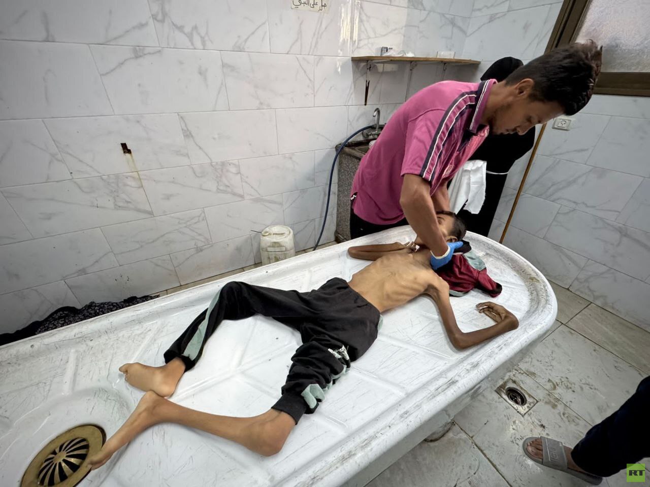 غزة: وفاة أطفال وطاقم طبي ينهار في مجمع الشفاء ضمن ضحايا الجوع