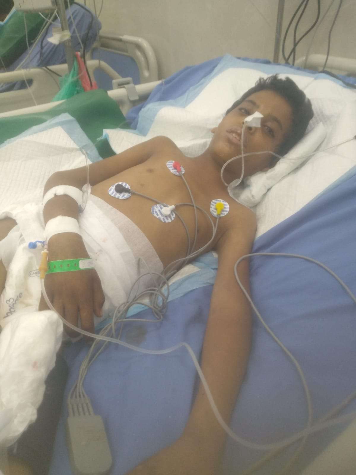 وفاة الطفل عدي عبدالعزيز متأثرًا بإصابته برصاص قناص حوثي في كرش