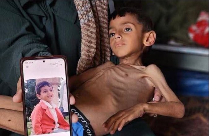 صحة غزة تحذر من مجاعة كارثية تهدد حياة أكثر من مليوني فلسطيني