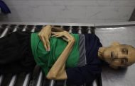 مسؤول صحي بغزة: إصابة ألف بالغ بسوء التغذية في 3 أسابيع