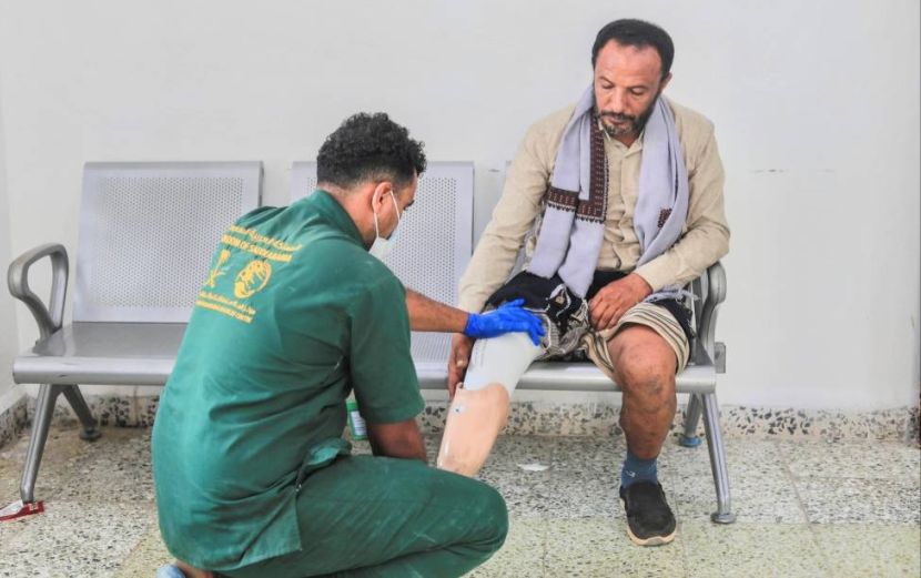 مركز الأطراف الصناعية وإعادة التأهيل بتعز يعلن عن عدد المستفيدين من خدماته خلال شهر يوليو 2025