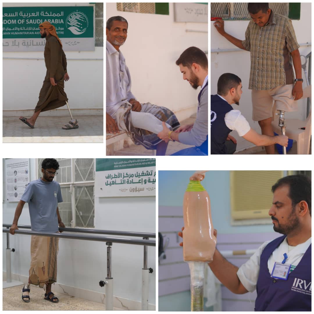 مركز الأطراف الصناعية بسيئون يواصل خدمة ضحايا الإعاقات والإصابات ويحقق إنجازات نوعية