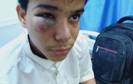 مطالبات أمنية وشعبية بالتحقيق في حادثة اعتداء طفل أمام إدارة أمن المكلا