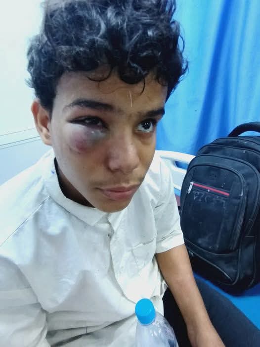 مطالبات أمنية وشعبية بالتحقيق في حادثة اعتداء طفل أمام إدارة أمن المكلا